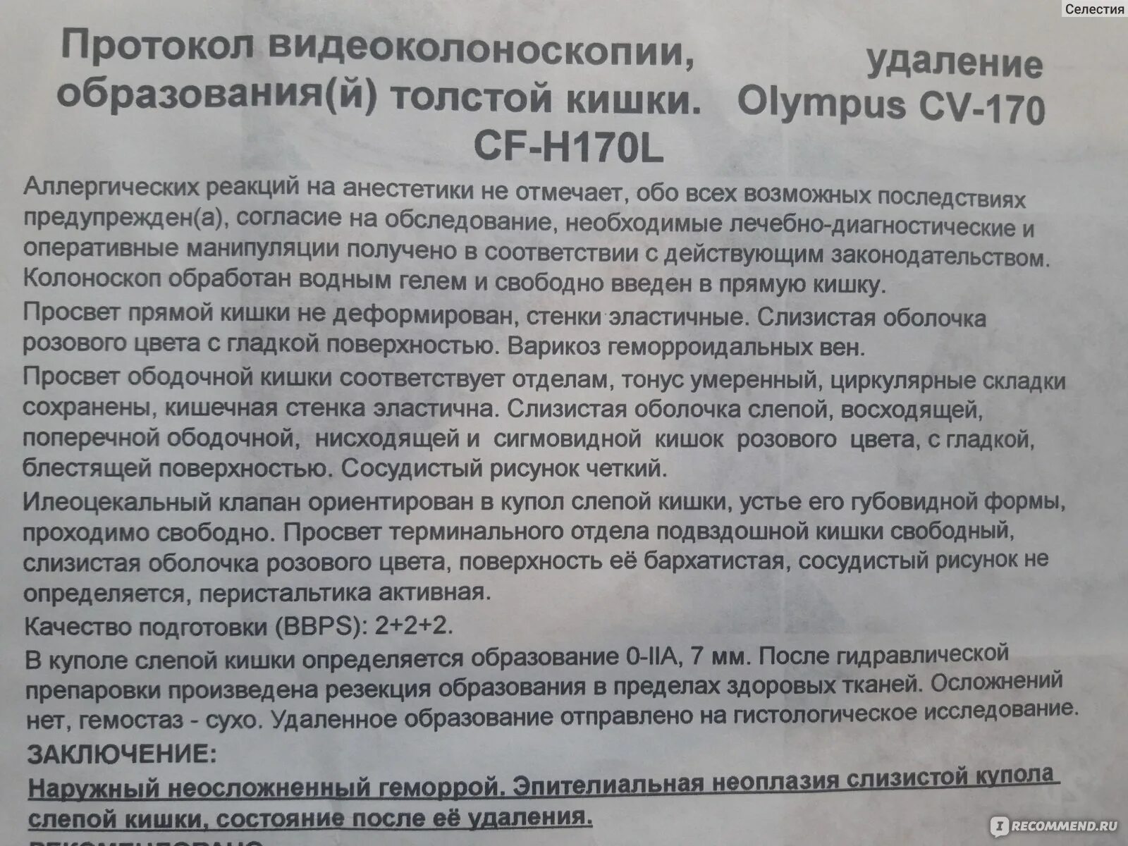 Колоноскопия женщине отзывы. Протокол анестезии при колоноскопии. Протокол подготовки к колоноскопии. Заключение по колоноскопии. Заключения после колоноскопии.