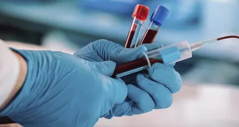 Blood work