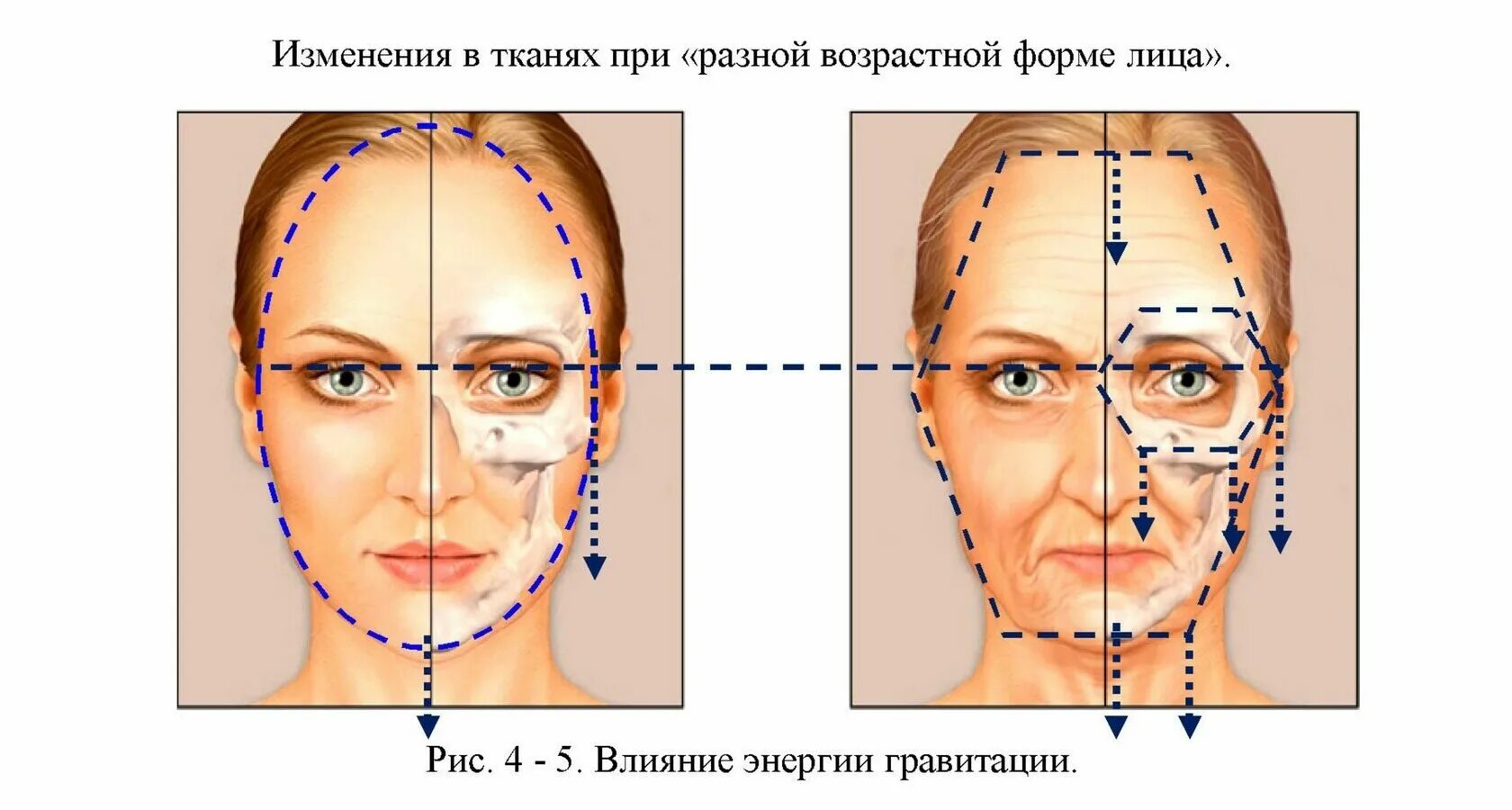Схема введения ботулотоксина. Схема введения ботокса на лице. Строение лица. Трети лица схема.