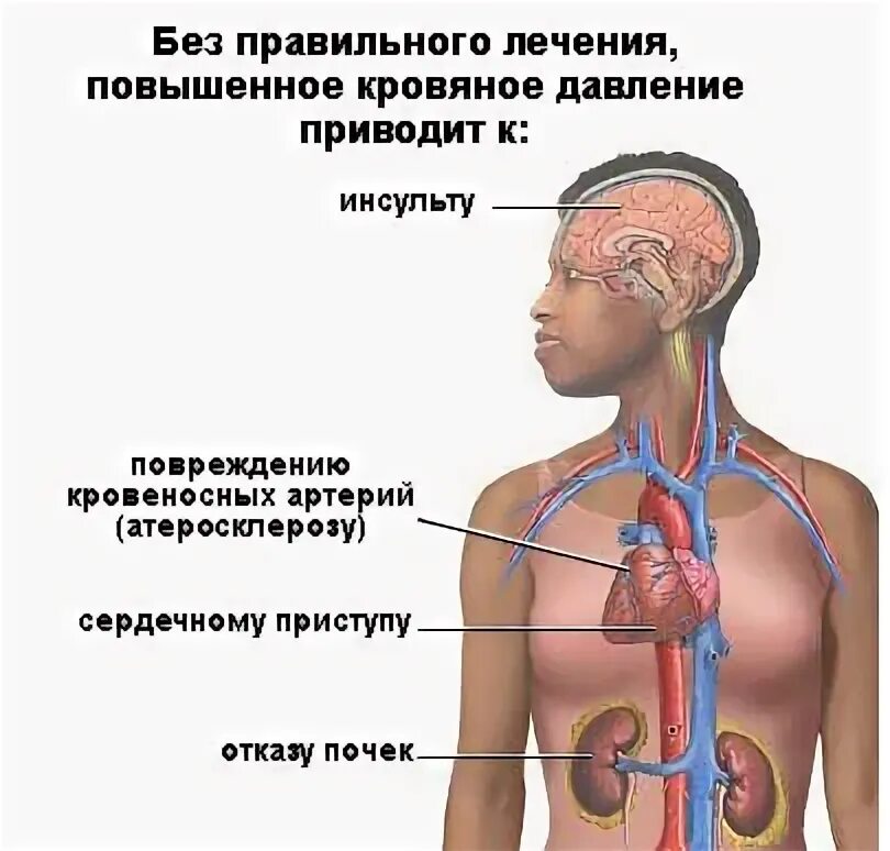 Симптомы повышено давления. Симптомы высокого Даале. Повышенное давление. Высокое давление симптомы. Симптомы высокого давления у человека.