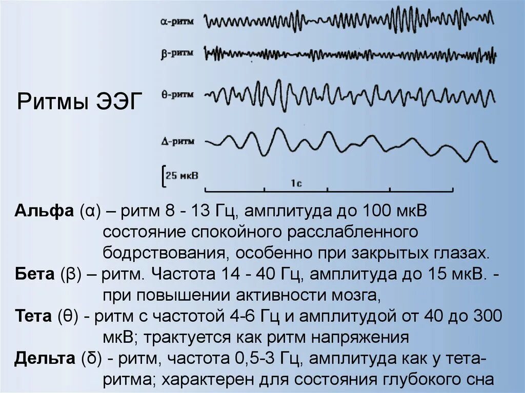 Частоты головного мозга. Альфа ритм бета ритм тета ритм Дельта ритм ЭЭГ. Характеристика Альфа ритма на ЭЭГ. Альфа и бета ритмы на ЭЭГ. Параметры Альфа ритма на ЭЭГ.