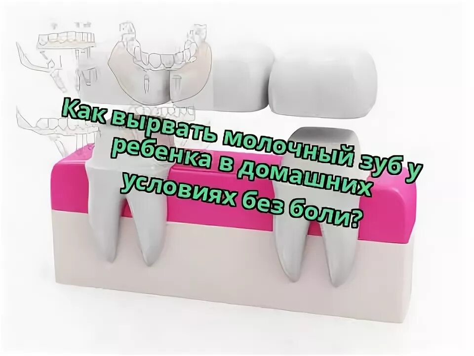 Как вытащить зуб ребенку. Как выдернуть молочный зуб ребёнку. молочный зуб у ребенка шатается как вырвать. как быстро выдернуть зуб дома.