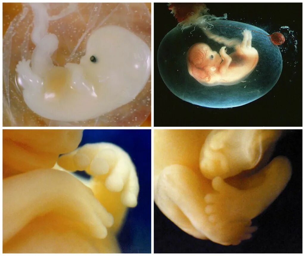 Акушерские и эмбриональные недели