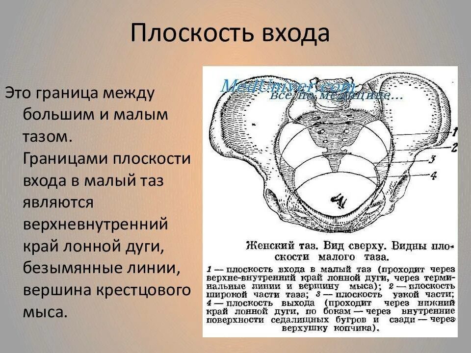 Большее между ними. Плоскосьб входа ВМАЛЫЙ таз. Плоскость входа в малый таз. Вход в малый таз границы. Плокстоть входа в малый таз.