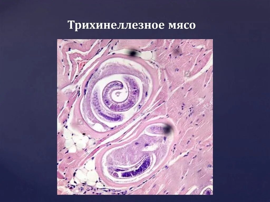 Микропрепарат личинок трихинеллы. Личинки трихинелл в мышечной ткани. Личинка трихинеллы в мышцах под микроскопом. Личинки трихинеллы под микроскопом.