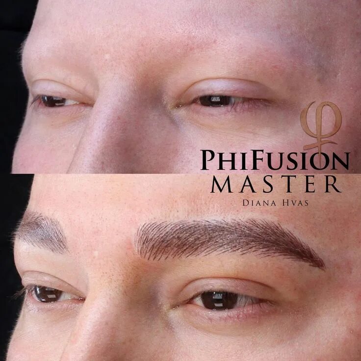 Перманентный макияж бровей мужской Head Tattoo Removal Unique Eyebrow Tattoo Removal Near Me Head tattoos, Tattoo r