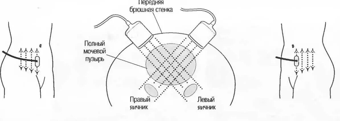 Расположение матки и мочевого пузыря. Проекция яичников на животе. Проекция яичн ка на переднюю брюшную стенку. Проекция яичников на переднюю. Проекция яичников на переднюю брюшную.