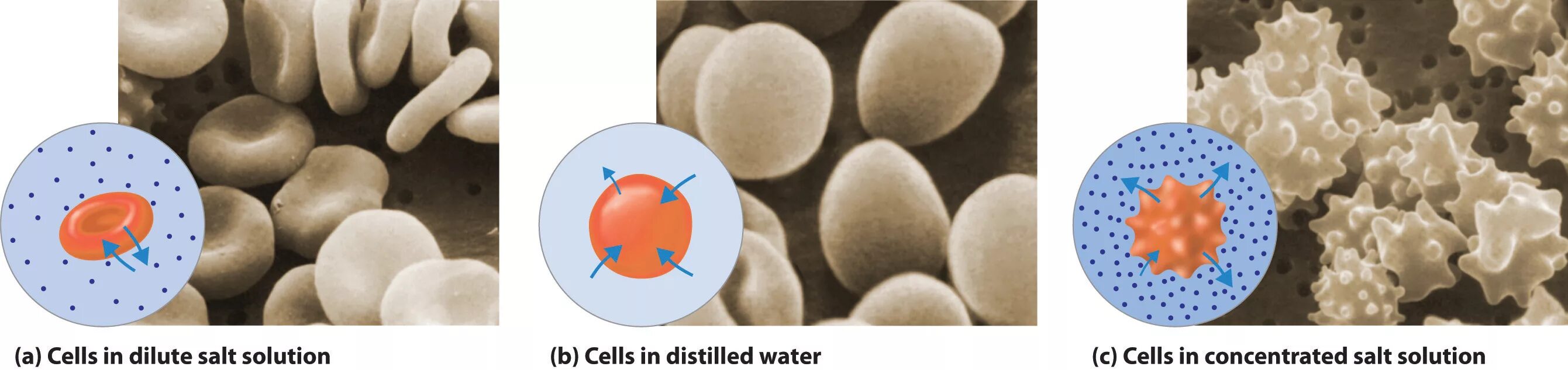 Эритроцит в соленой воде. Эритроцит в Соленом растворе. Набухший эритроцит. Осмос эритроцитов.