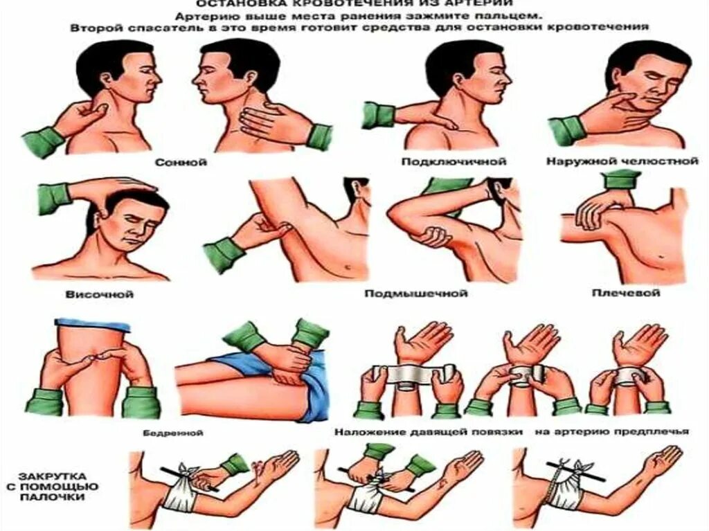 Какой способ артериального кровотечения наиболее эффективен. Оказание первой медицинской помощи артериальное кровотечение. Остановка кровотечения. Оказание первой медицинской помощи остановка кровотечения. Остановка кровотечения кратко.