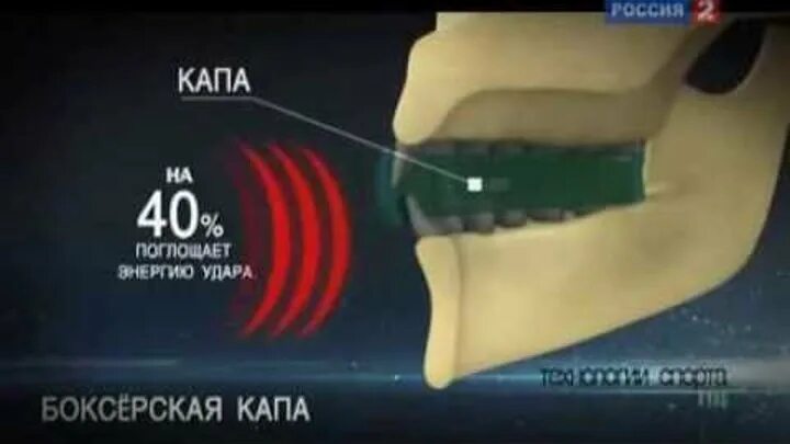 Капа россия. Боксерская Капа на зубах. Защита зубов боксера. Капа для бокса прокусил. Перчатки и Капа для бокса.