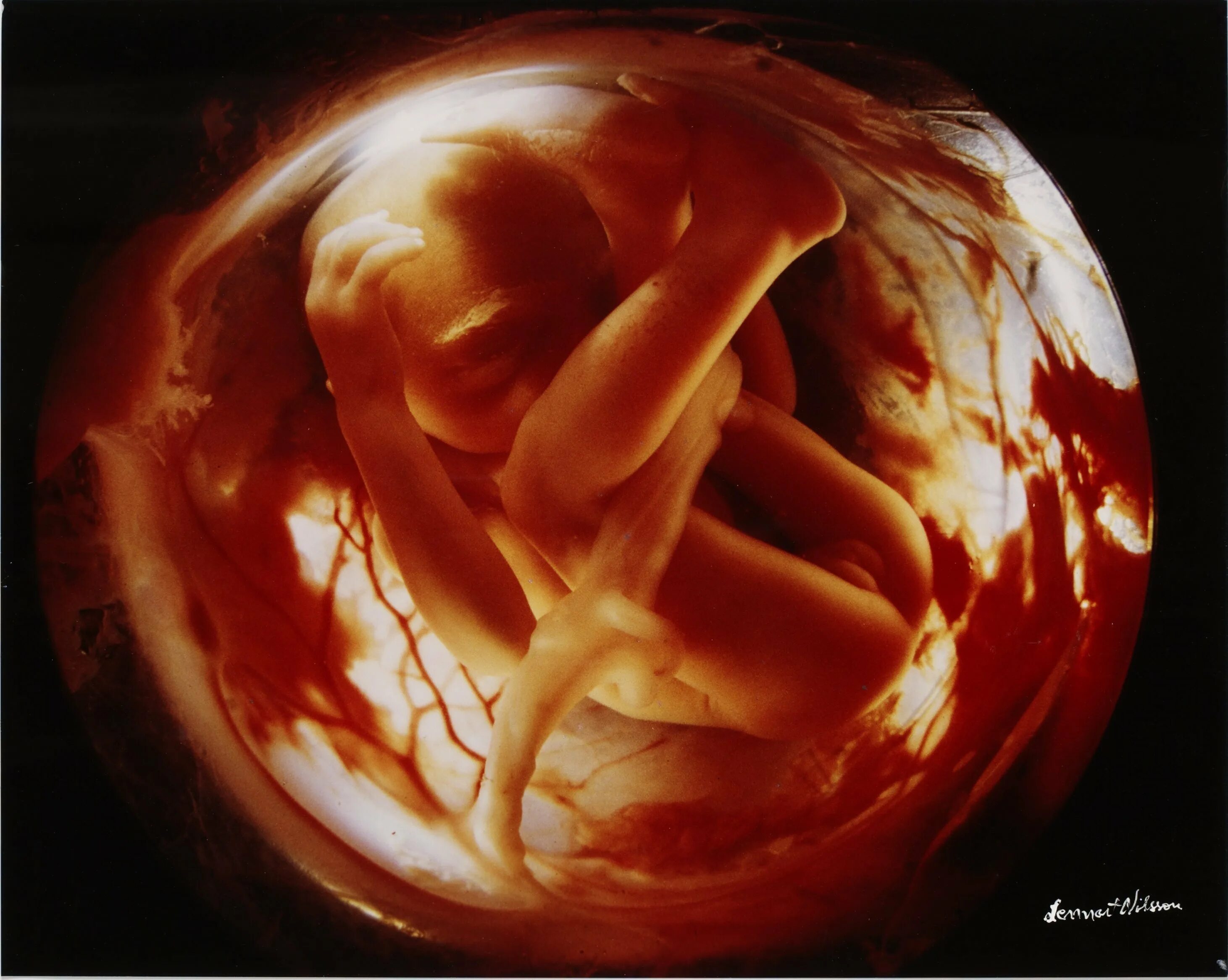 Эмбрион Леннарт Нильсон. Леннарт Нильсон снимки в утробе. Эмбрион 18 недель Леннарт Нильссон. Леннарт Нильсон Зарождение.