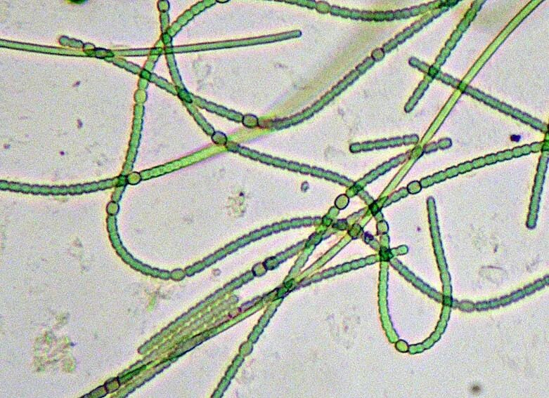 Носток цианобактерия. Носток микроскоп. Носток водоросль. Колония ностока. Гриб водоросль цианобактерия