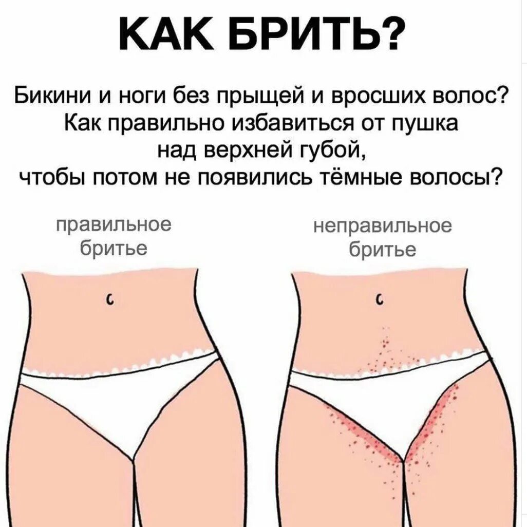 Формы половых губ у девушек