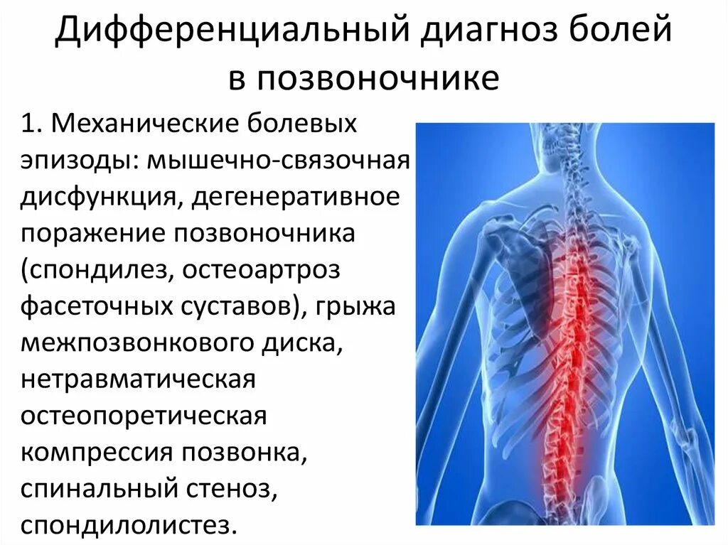 Боли в спине без температуры. Дифференциальный диагноз болей в позвоночнике. Диф диагностика болей в спине. Дифференциальная диагностика межпозвоночной грыжи. Дифференциальный диагноз межпозвоночная грыжа.