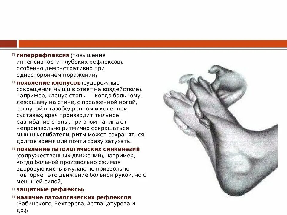 Клонус центральный паралич. Сухожильный паралич. Сухожильные рефлексы неврология. Повреждение лучевого нерва. Кожные и сухожильные рефлексы человека.