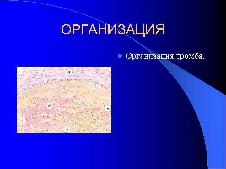 Организация Инкапсуляция метаплазия. Перестройка тканей это в патологии. Перестройка тканей и метаплазия. Регенерация организация склероз. Организация тромба