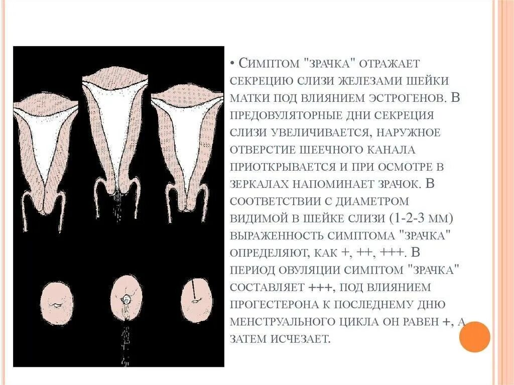 Овуляция половые губы. Симптом зрачка шейка матки. Расположение матки при овуляции.