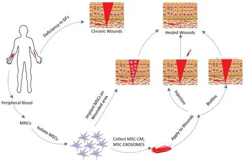 Wound healing