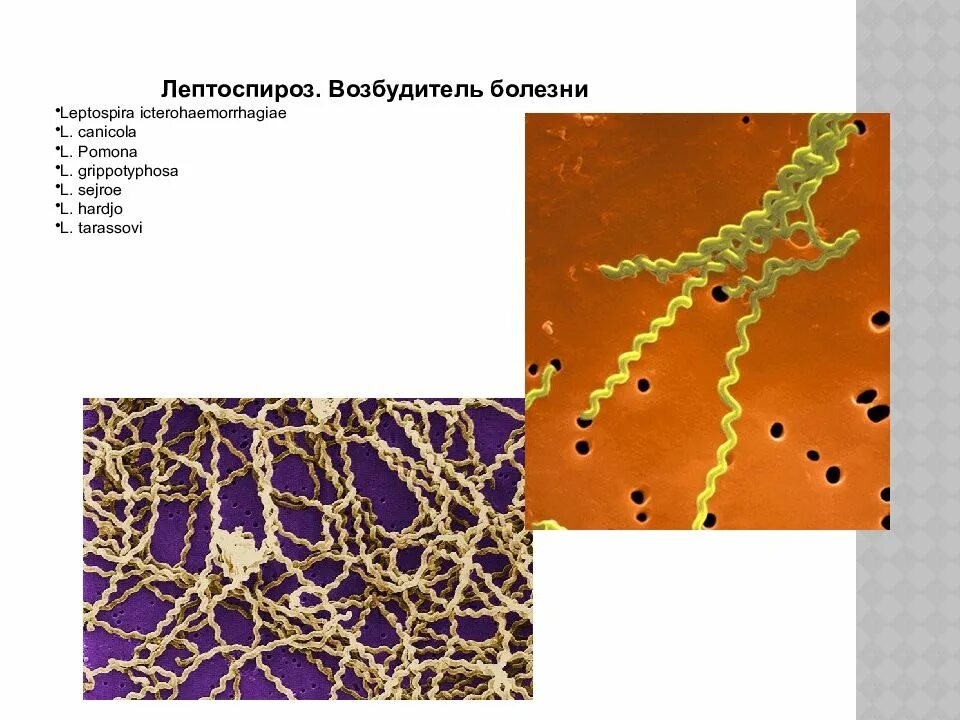 Лептоспироз (возбудитель болезни относятся к виду Leptospira interrogans). Лептоспироз спирохеты. Возбудитель лептоспироза микробиология. Лептоспироз антигенная структура. Больной лептоспирозом