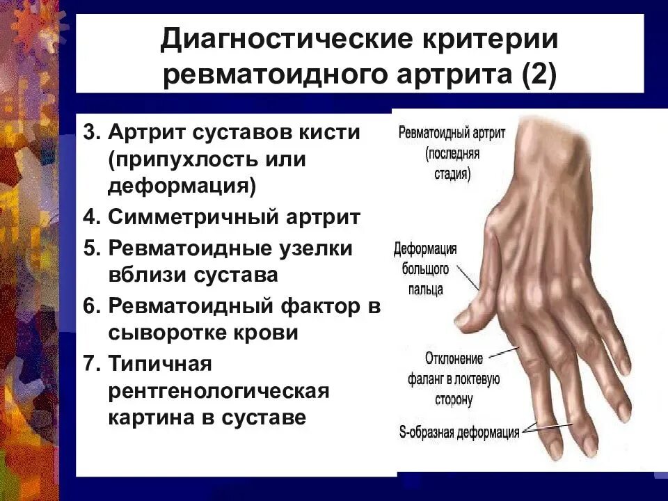 Ревматические осложнения. Суставные поражения при ревматоидном артрите. Ревматоидный артрит симметричное поражение суставов. Ювенильный ревматоидный артрит клиническая картина. Симптомы поражения суставов ревматоидного артрита.