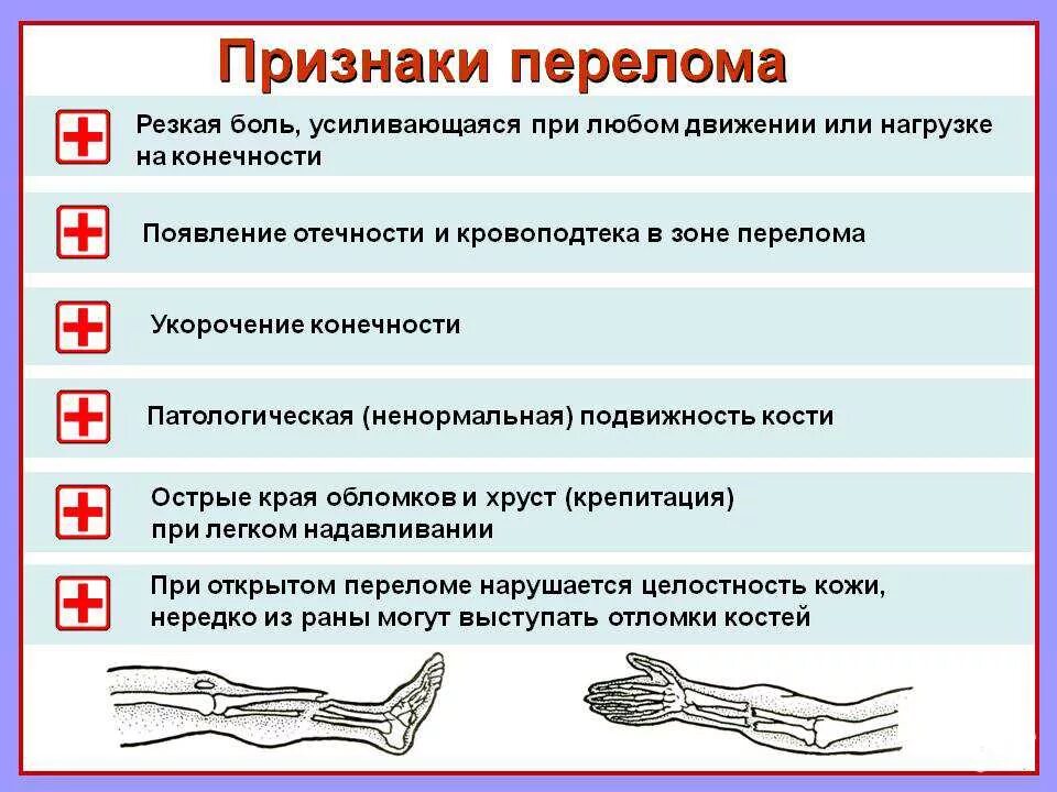 Сколько болит перелом ноги. Признаки открытого и закрытого перелома. Основные симптомы перелома костей конечностей. Общие признаки перелома кости конечности. Признаки закрытого перелома кости.