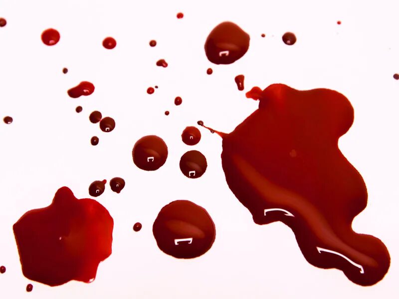Pretty blood. Pretty blood