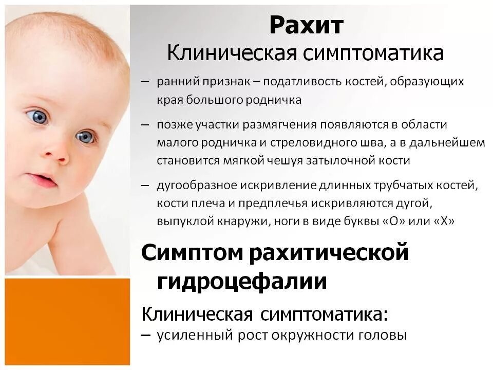 Разит значение. Симптомы рахита у детей 6 месяцев. Симптомы рахита у грудничка в 6 месяцев. Рахит недостаток витамина д. Симптомы рахита у детей 1 года причины.
