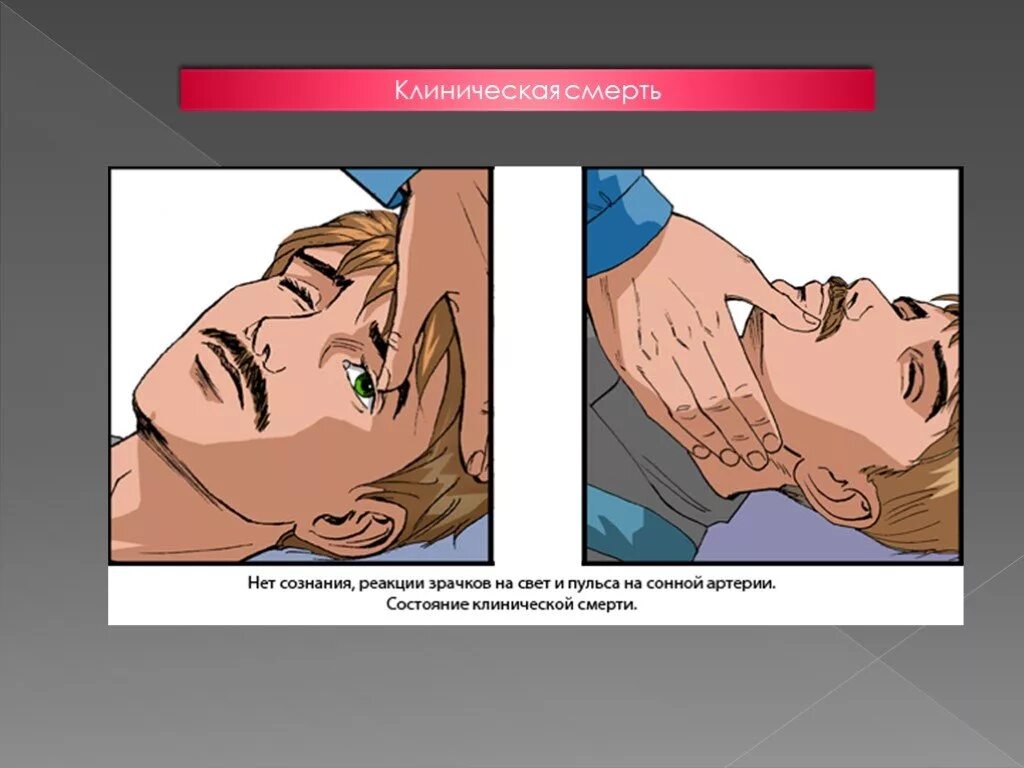 Отсутствие реакции зрачка на свет признак отсутствия. Реакция зрачков на свет при клинической смерти. Реакция зрачков на свет у пострадавшего. Отсутствие реакции зрачка на свет. Признаки смерти пострадавшего.