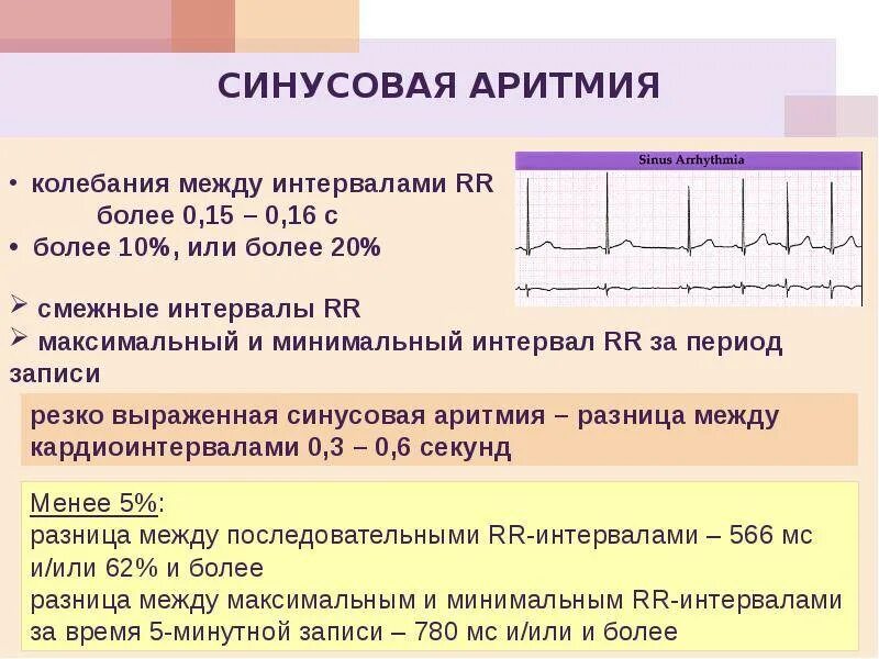 Аритмия норма пульса. Синусовая аритмия на экг расшифровка. нормы по экг синусовая аритмия. кардиограмма сердца расшифровка синусовый ритм норма. синусовый ритм сердца на экг у взрослого норма.
