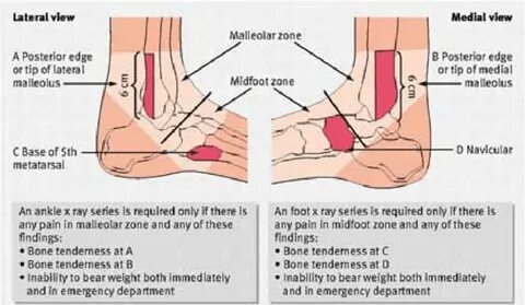 Ankle перевод