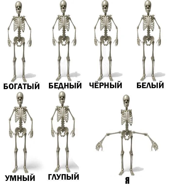 Канал а 4 бедный богатый. Статуэтка рукожоп. Скелет рукожопа. Богатый и бедный.