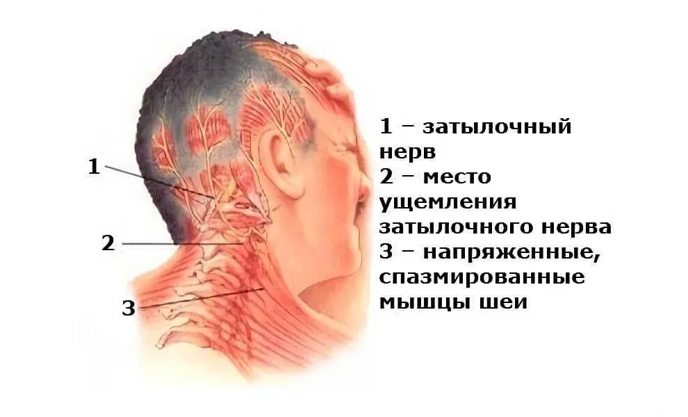 Боли в шеи после удара. Боли в шеи после удара