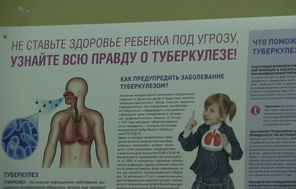 Ребенок инфицирован туберкулезом. Прививка на туберкулёз реакция. Прививка от туберкулеза детям.