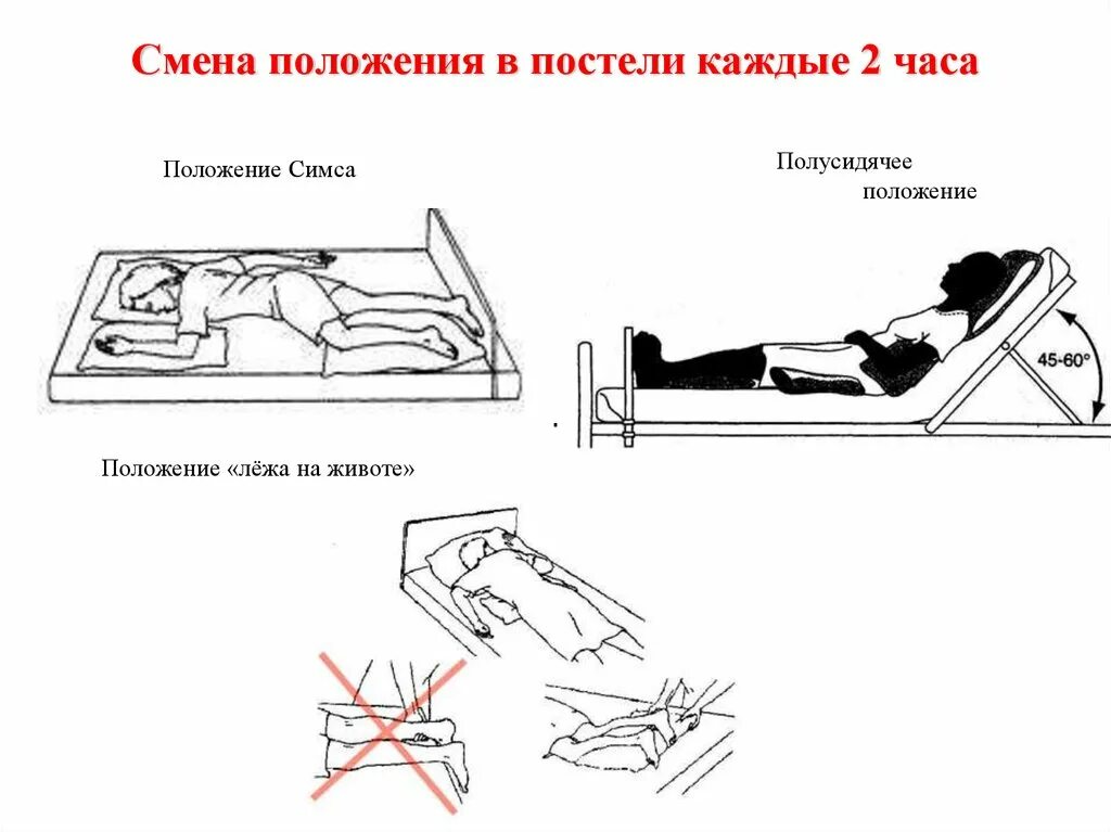 Пролежни положение Фаулера и симса. Профилактика пролежней положение симса и Фаулера. Положение симса и Фаулера для лежачих больных. Положение Фаулера профилактика пролежней. Метод изменения позиции