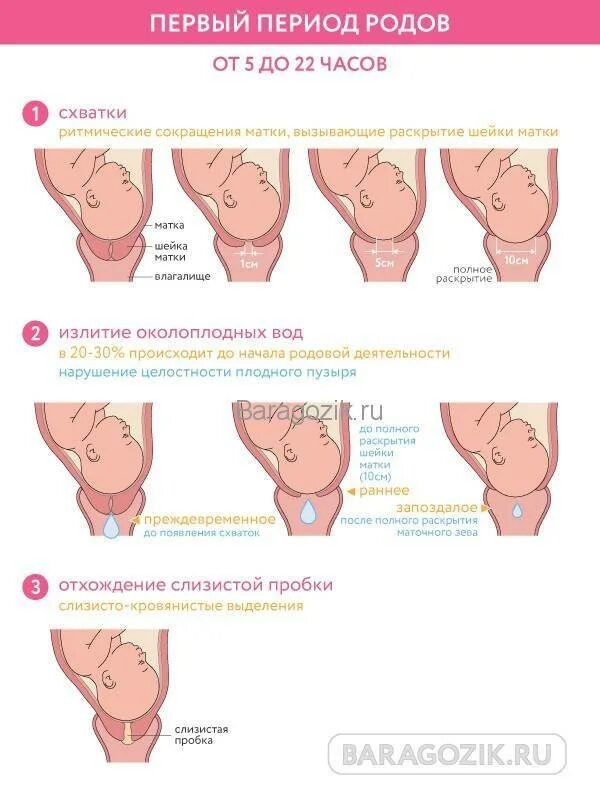 Раскрытие шейки матки 1 см. Периоды родов по раскрытию шейки матки. Норма раскрытия шейки матки. Этапы родов у первородящих.