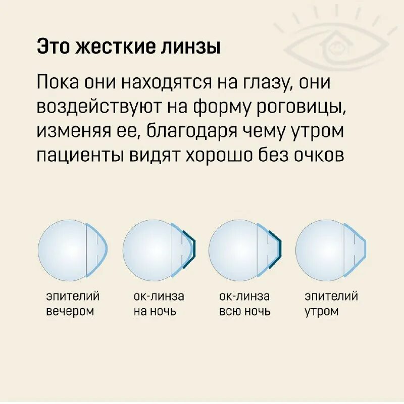 Сколько нужно спать в ночных линзах. Окл линзы. Линзы ночные для коррекции. Ночные жесткие линзы для восстановления зрения. Ночные линзы для восстановления зрения для детей.