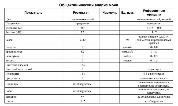 Изменения показателей мочи. Общий анализ мочи норма таблица. Анализ мочи нормальные показатели - таблица. Общий анализ мочи норма и расшифровка результатов таблица у женщин. Норма анализов мочи у женщины таблица общий.