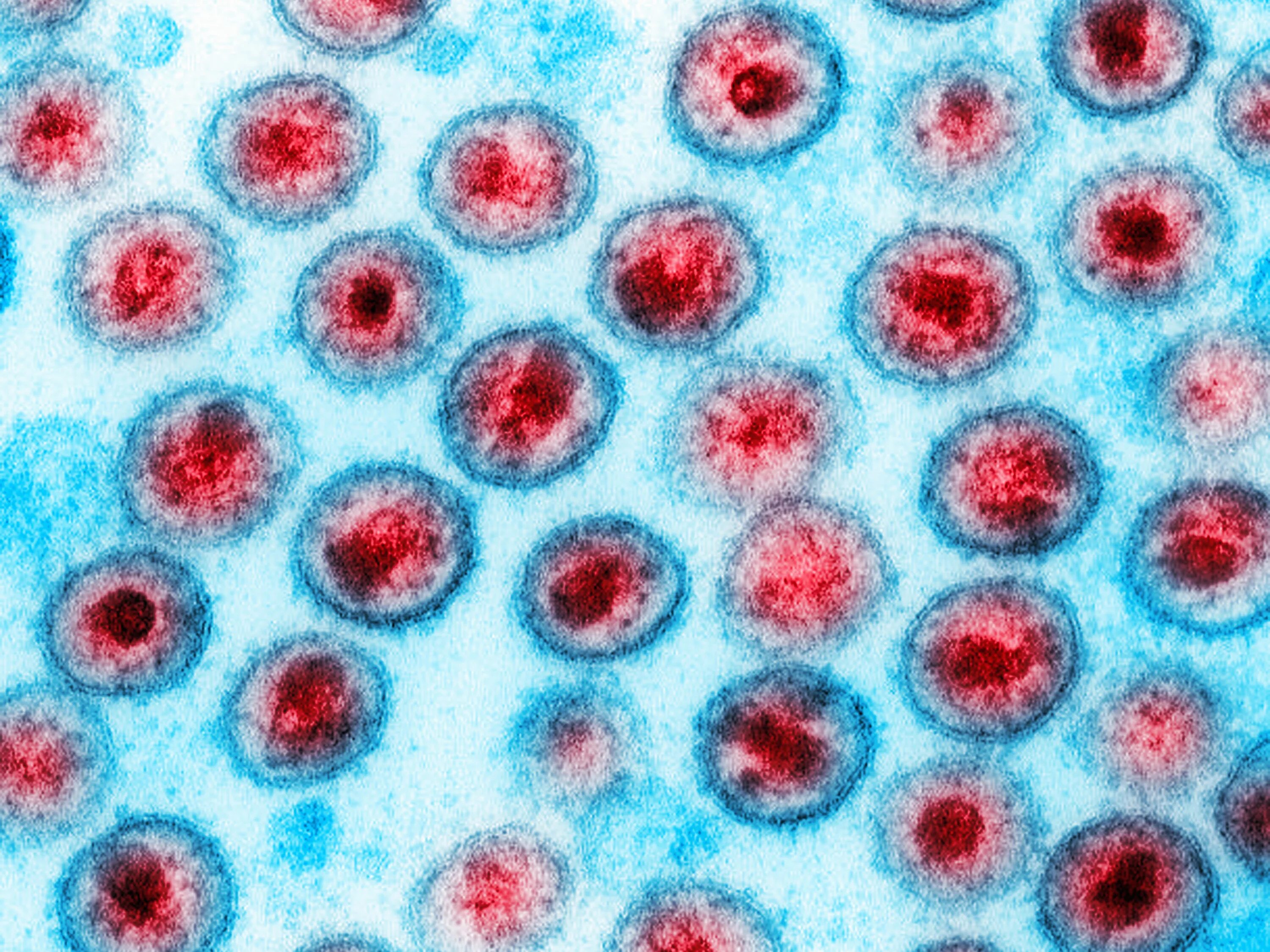 Вирус СПИДА под микроскопом. Вирус иммунодефицита под микроскопом. Вирус ВИЧ под микроскопом.