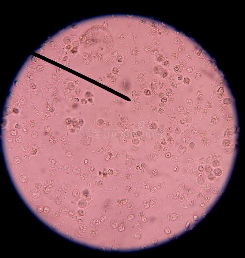 blood cells Science nature, Blood cells, Microbiology