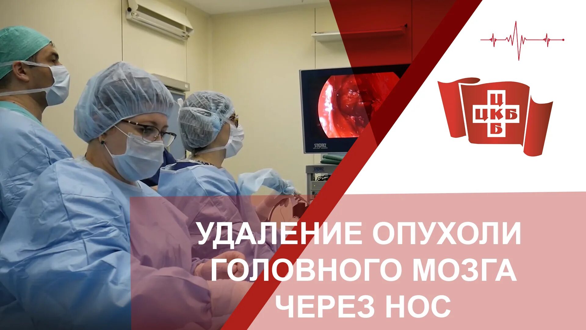 Опухоли головного мозга презентация. После операции на опухоль мозга. Удаление опухоли мозга. Нейрохирургия операции. Опухоль головного мозга операция.