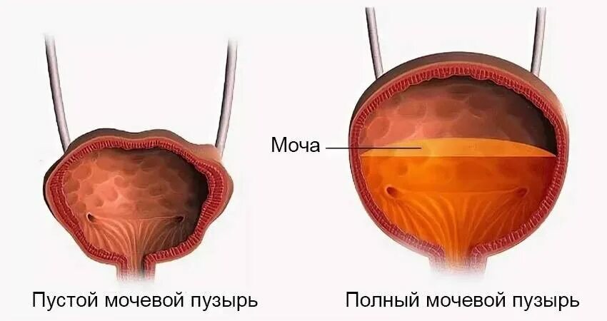 Мочевой пузырь. Наполненный мочевой пузырь.