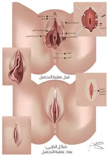 شكل المهبل قبل وبعد الزواج بالصور - chemsystem.ru.