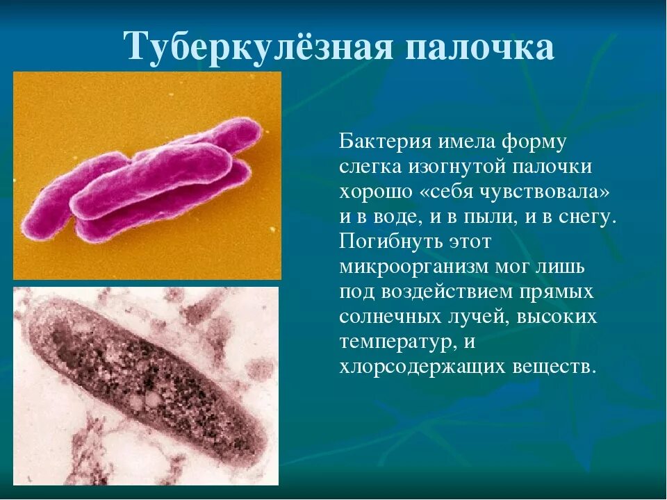 Заболевание туберкулез вызывают бактерии. Палочка Коха форма бактерии. Палочка Коха возбудитель туберкулеза. Туберкулезная палочка палочка Коха. Микобактерия туберкулеза палочка Коха.