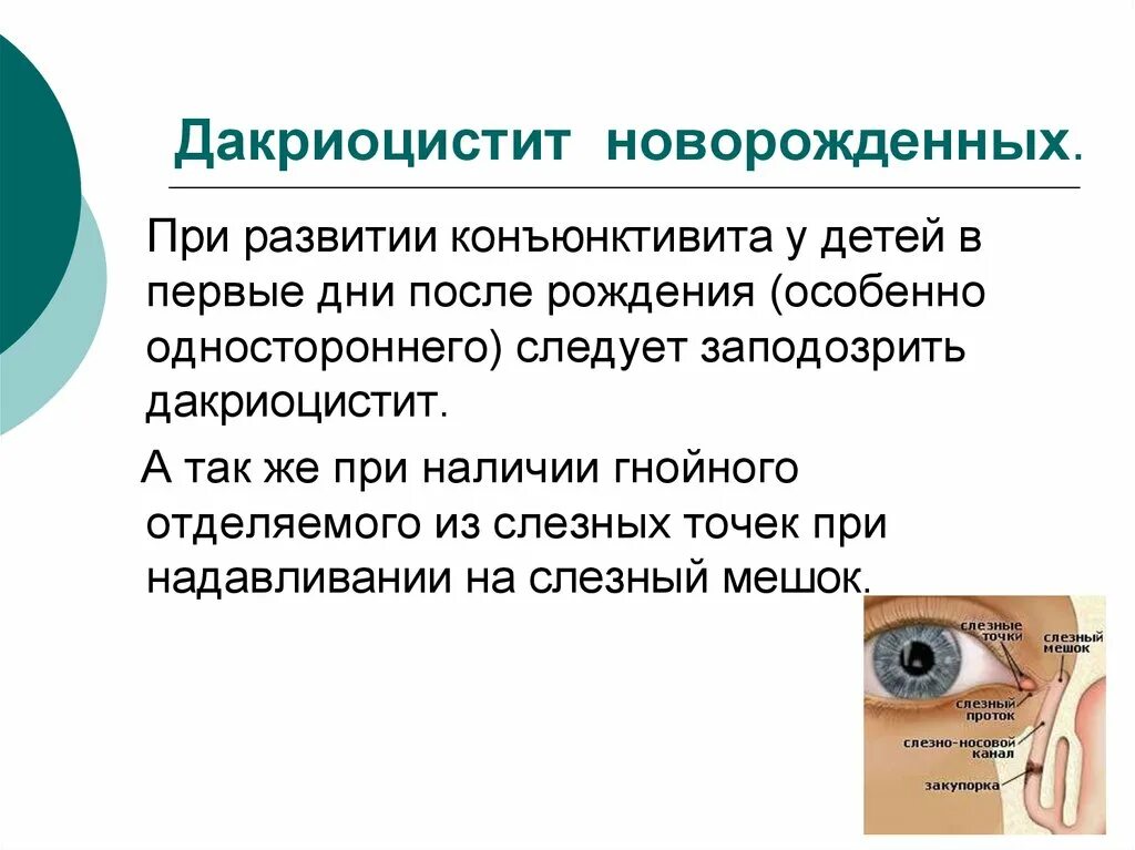 Дакриоцистит как делать массаж. Дакриоцистит новорожденных клинические рекомендации. осложнения дакриоцистита. непроходимость носослезного канала у новорожденных.
