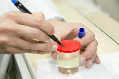 Почему врачи часто назначают анализ мочи? Клиника Радуга