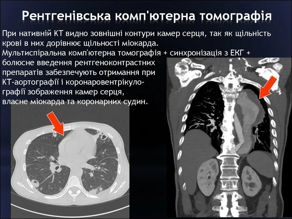 Что такое ркт. Рентгеновская компьютерная томография. Рентгеновская компьютерная томография (РКТ). Принцип компьютерной томографии. Основы рентгеновской компьютерной и магнитно-резонансной томографии.