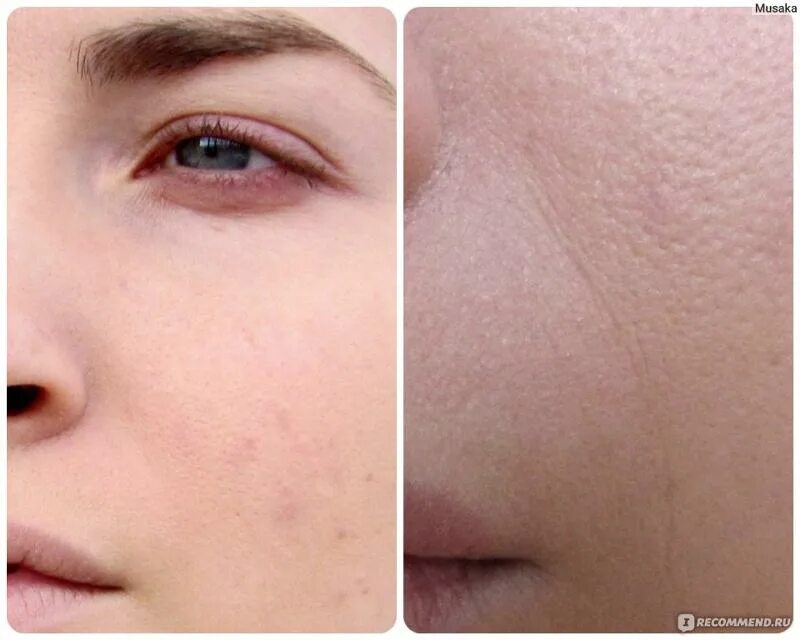 Тональник скатывается. Тон скатывается. Скатывается тональный крем. Тональный крем скатывается в поры. Скатывается тональный крем на лице.