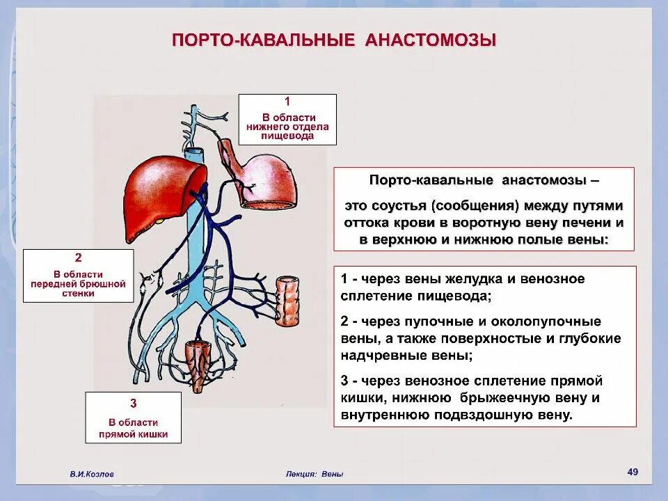 Схема венозных анастомозов. Порто портальный. Порто портальный. Анатомия системы портокавальных анастомозов. Анастомозы вен портокавальные.
