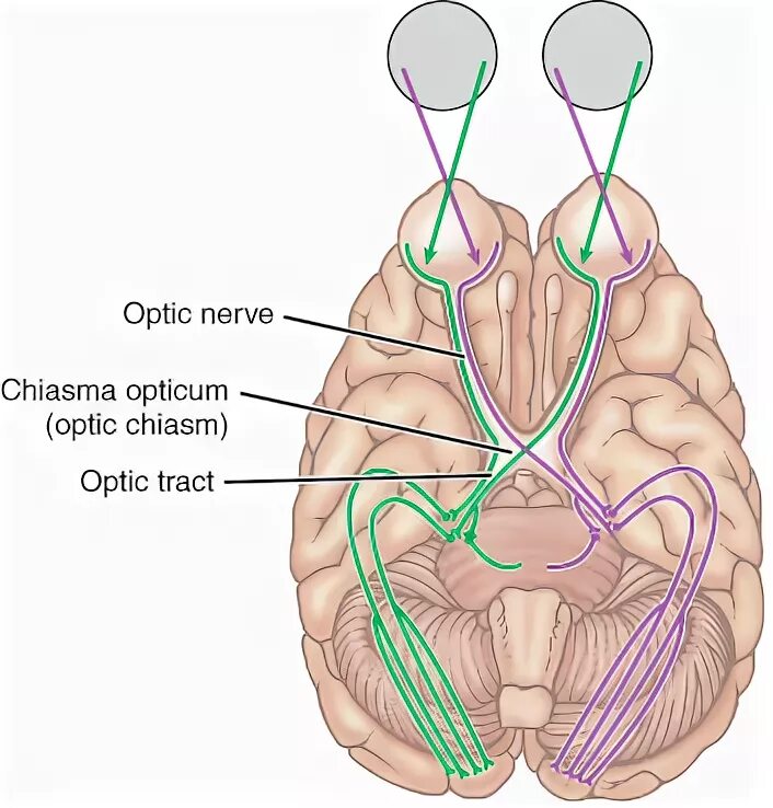 Зрительный нерв в головном мозге. Хиазма Оптикум. Chiasma Opticum на препарате. Хиазма головного мозга. Зрительный Перекрест.