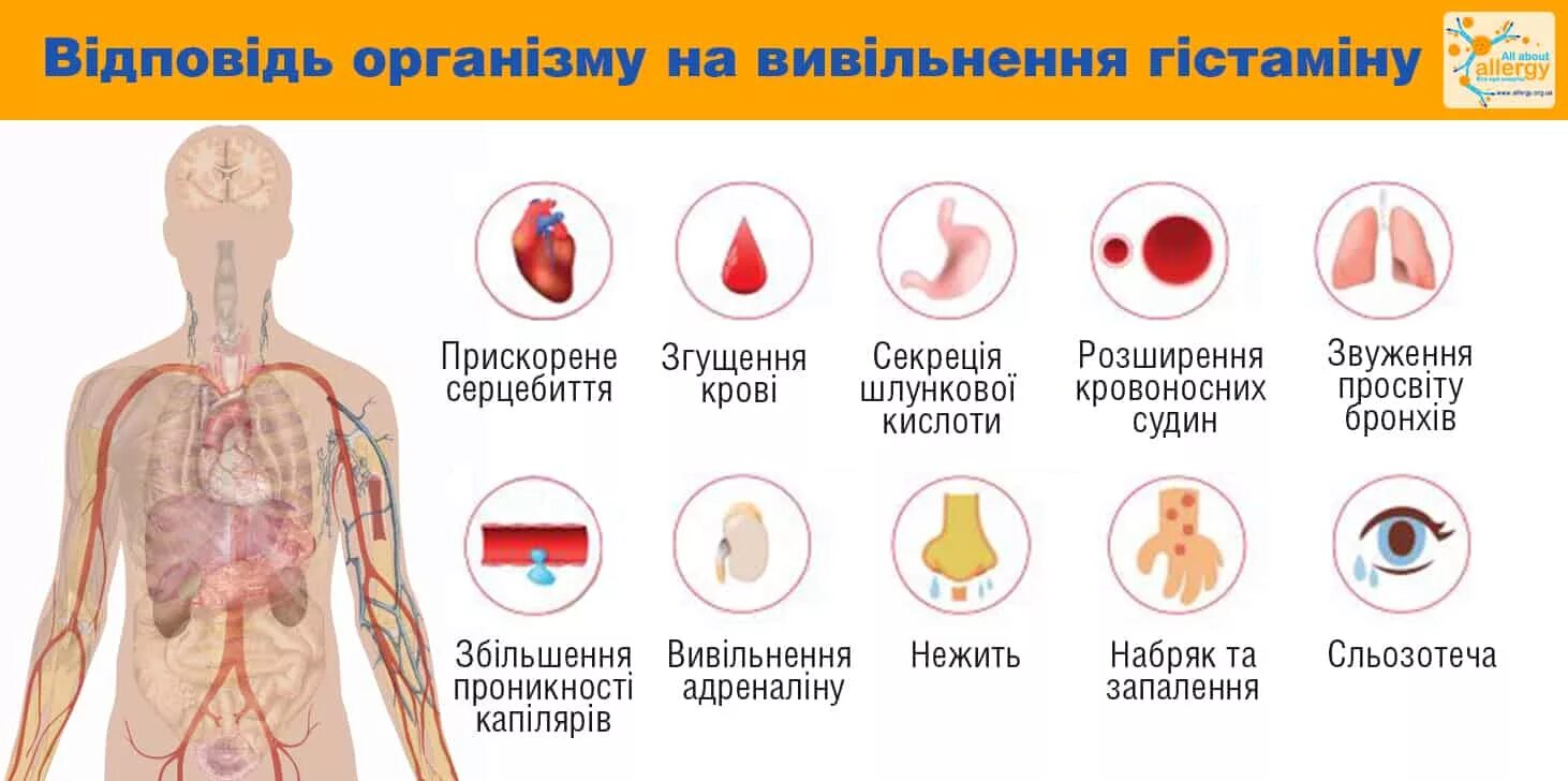 Гистамин аллергия. Непереносимость гистамина. симптомы гистамина. непереносимость гистамина симптомы. histamine аллергия.